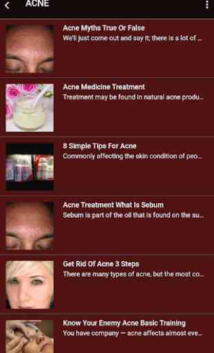 Acne Treatment Guide 2