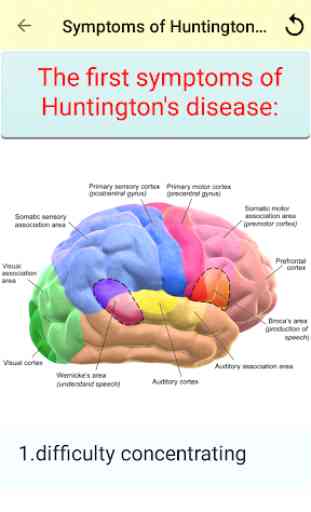 Huntington's Disease 4