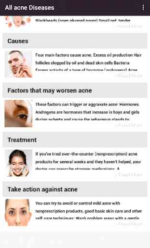 Acne Treatments & Remedies 1