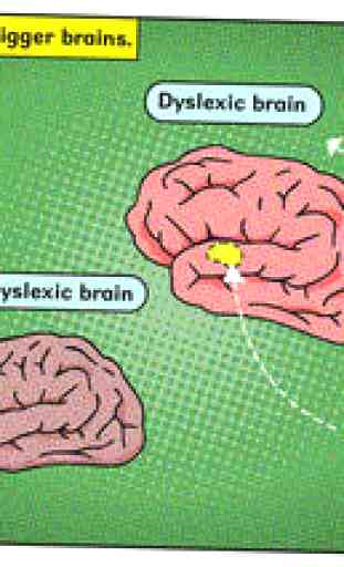 What is Dyslexia? 4