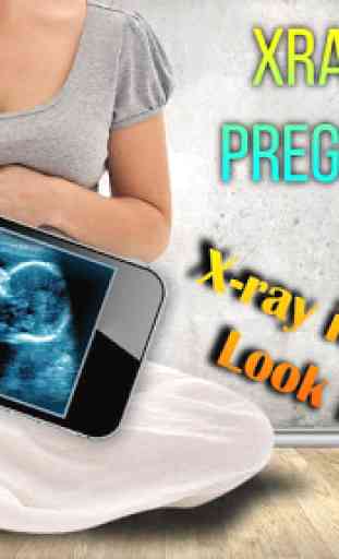 Xray Scanner Pregnant Prank 1