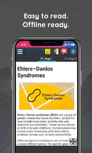 Ehlers–Danlos Syndromes 2