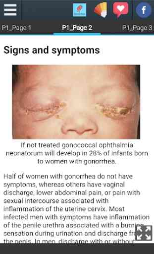 Gonorrhea Info 4
