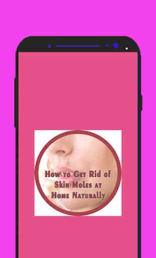 How to Get Rid of Skin Moles at Home Naturally 1