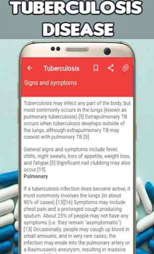 Tuberculosis: Causes, Diagnosis, and Management 2