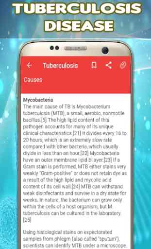 Tuberculosis: Causes, Diagnosis, and Management 4
