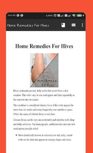 Home Remedies For Hives 2