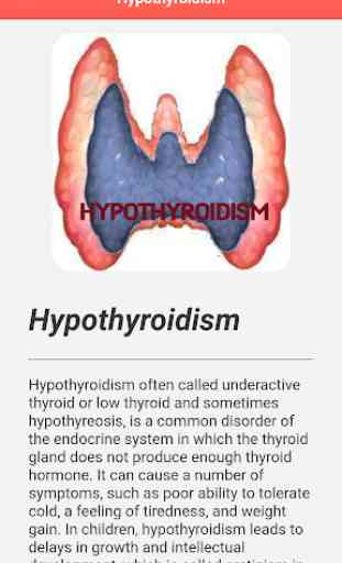 Hypothyroidism Disease 4