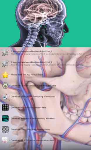 Imaging Brain, Skull & Craniocervical Vasculature 2