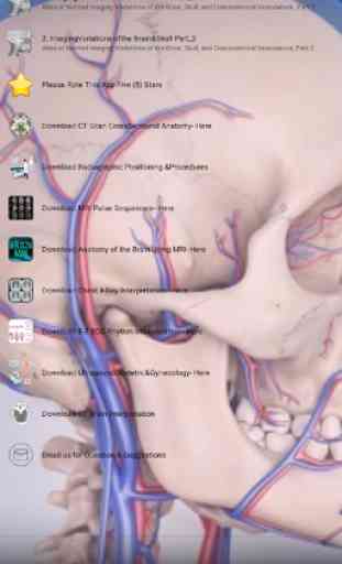 Imaging Brain, Skull & Craniocervical Vasculature 3