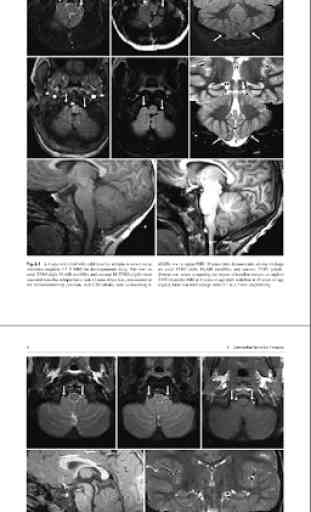 Imaging Brain, Skull & Craniocervical Vasculature 4