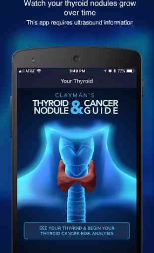 Thyroid Nodule and Cancer Guide 1