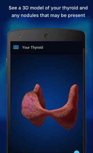 Thyroid Nodule and Cancer Guide 2
