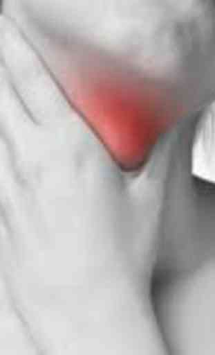 underactive thyroid 1