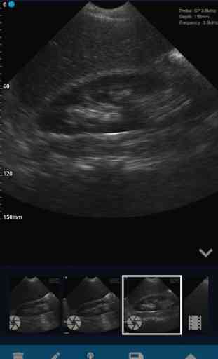 VistaScan Ultrasound App 1