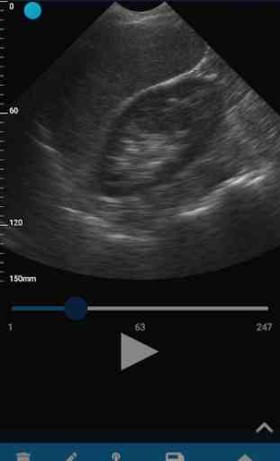 VistaScan Ultrasound App 2