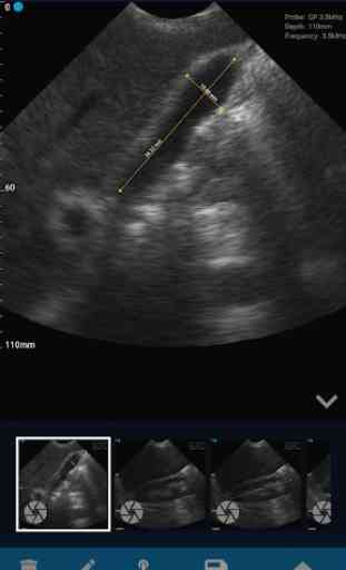 VistaScan Ultrasound App 3