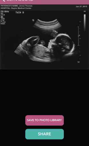 Baby Ultrasound 2015 1