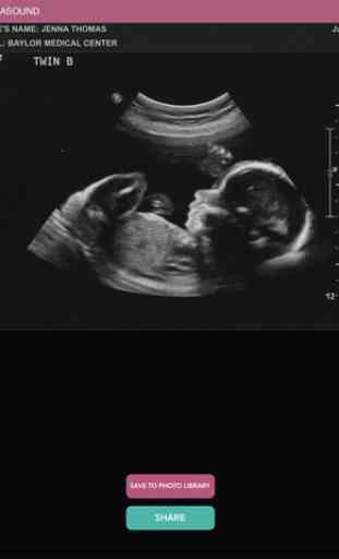 Baby Ultrasound 2015 3
