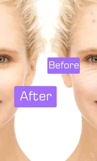 My visage camera - Remove your face acne , skin wrinkles eraser and blemish 2