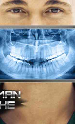 X-Ray Human Teeth Joke 3