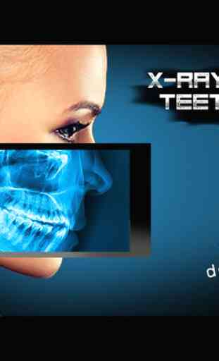 X-Ray Human Teeth Joke 4