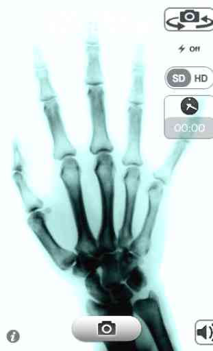 X-Ray Scan + Free 1