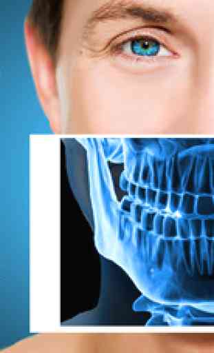 Xray Scanner Teeth Prank 1