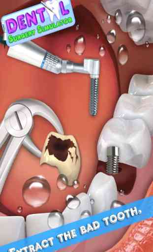 Dental Surgery Simulator - Dentist Clinic 3