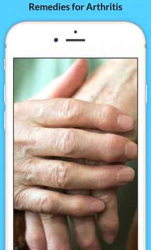 Arthritis - Signs of Arthritis and Natural Remedies 1