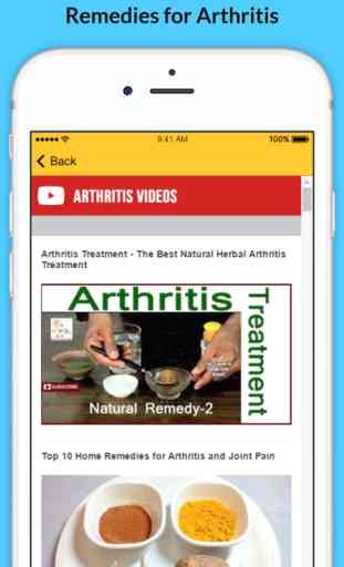 Arthritis - Signs of Arthritis and Natural Remedies 4