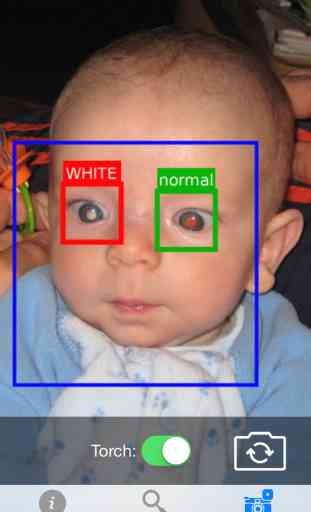 White Eye Detector 2