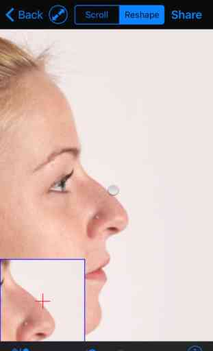 FaceTouchUp Nose Job & Rhinoplasty Simulator 2