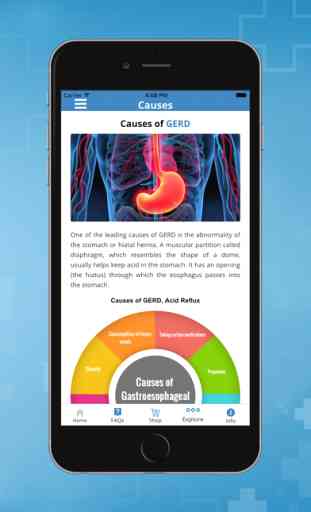 GERD, Heartburn and Acid Reflux Symptoms & Remedies 4