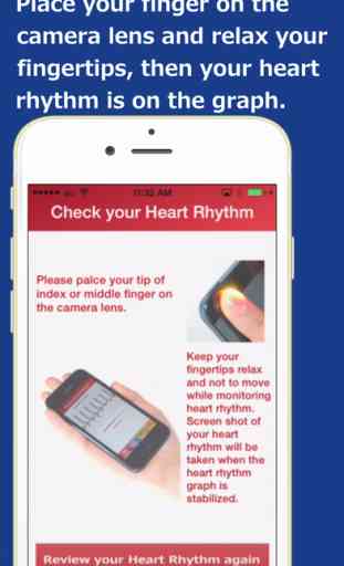 Heart_Rhythm   Heart Rhythm App finds risk for onset of Stroke Risk 2