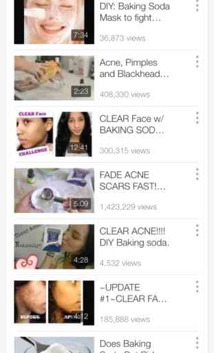 How To Get Rid Of Acne - Easy Home Remedies 3